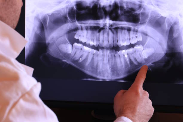 Best Emergency Treatment for Toothache in Irvington, KY