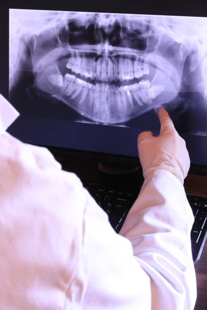 Best Emergency Tooth Extraction in Irvington, KY
